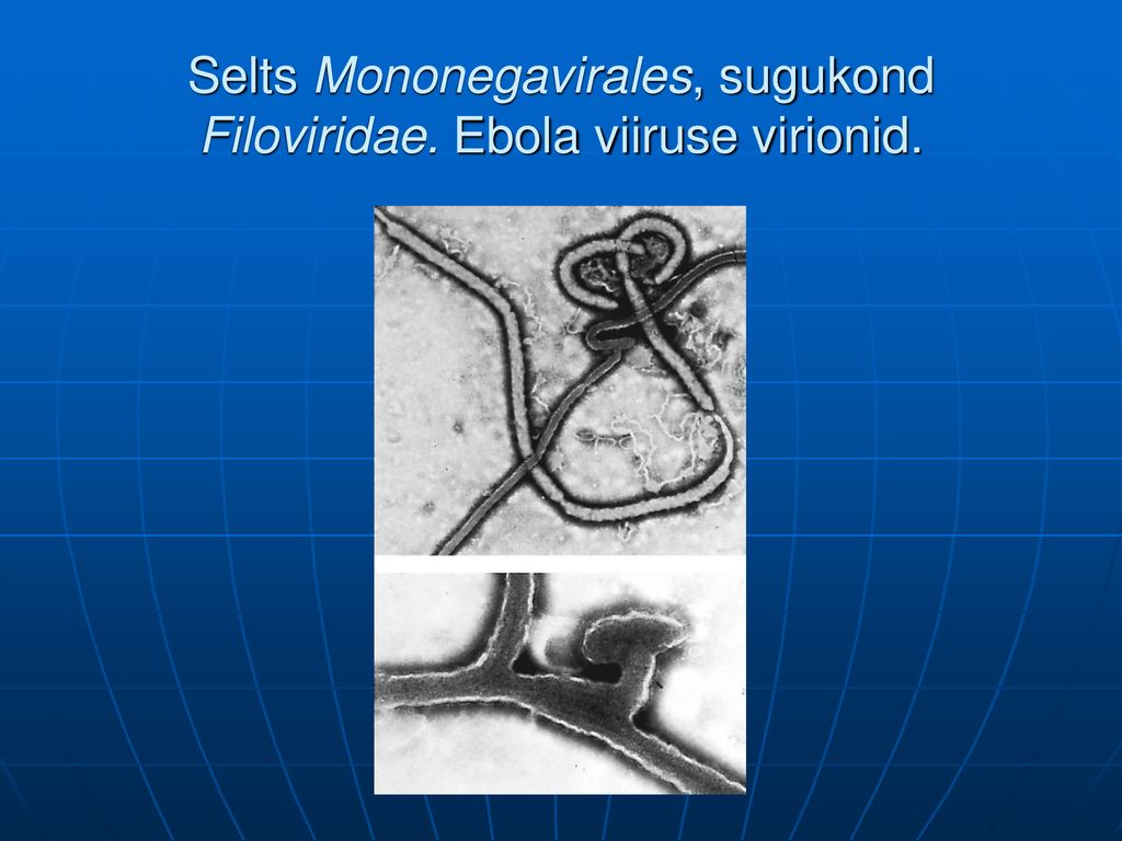 Selts Mononegavirales, sugukond Filoviridae. Ebola viiruse virionid.
